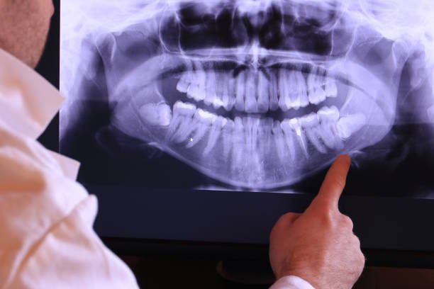 Best Dentist for Tooth Abscess  in Vicksburg, MS