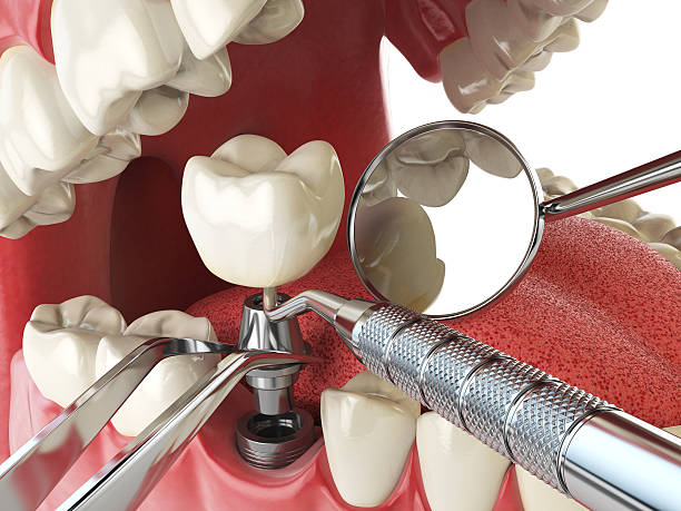 Best Broken Tooth Emergency  in Vicksburg, MS